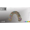 Activity 300 - стоматологический 3D-сканер | SmartOptics