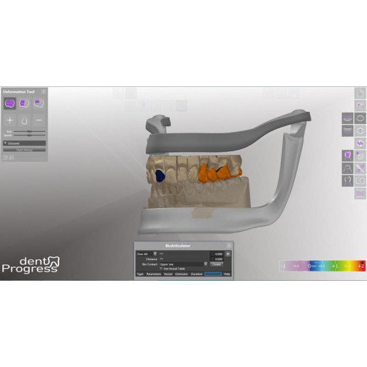 Activity 885 - стоматологический 3D-сканер | SmartOptics