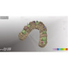 Activity 885 - стоматологический 3D-сканер | SmartOptics