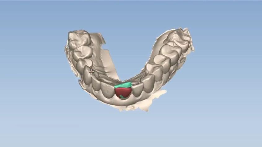 3D модель челюсти