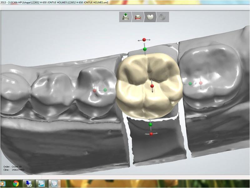 ротовая полость расположение зуба картинка 3д
