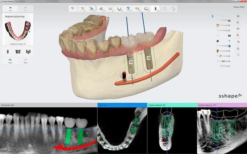 схема зубного ряда и снимки рентген