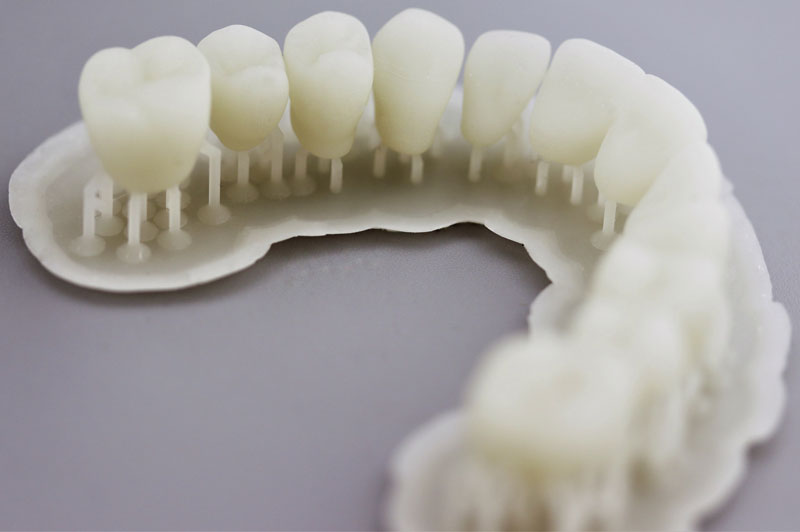 3Д печать. стоматология, коронки и мосты