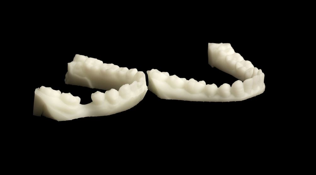 Слепок, зубы, Печать на 3D принтере UnionTech Pilot SD
